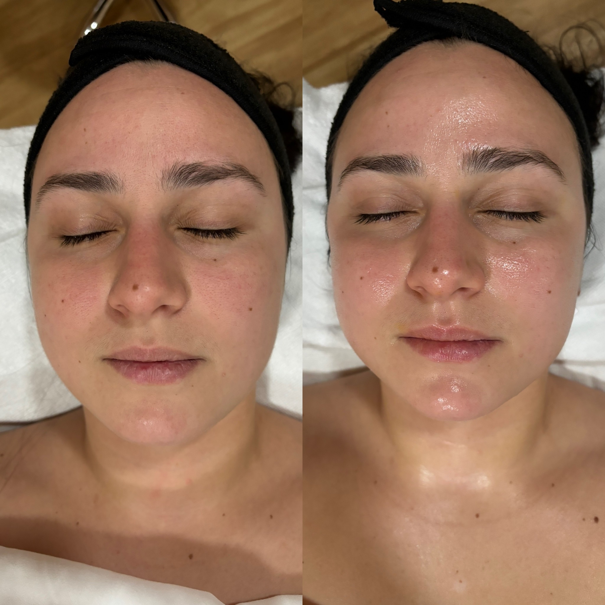 Before and After 0-1